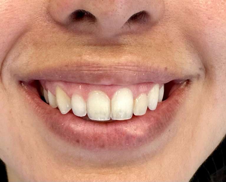 Case-Before-Image