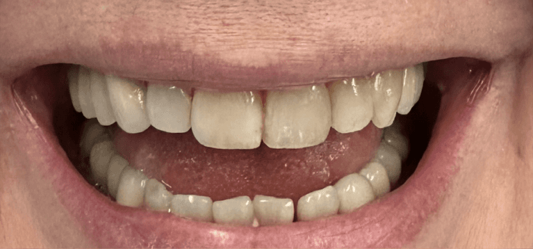 Case-Before-Image