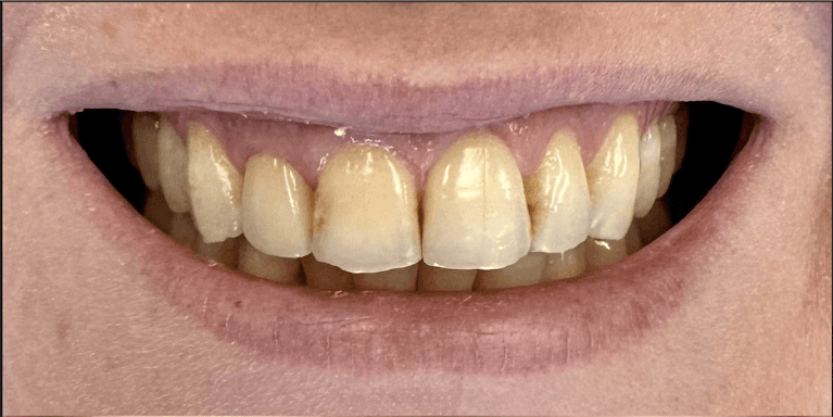 Case-Before-Image