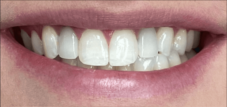 Case-Before-Image