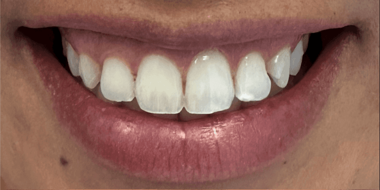 Case-Before-Image