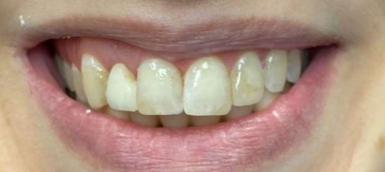 Case-Before-Image